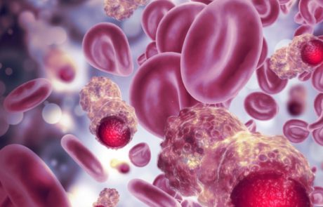 כל מה שרצינו לדעת על סרטן