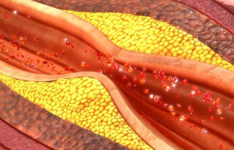 המאכלים הללו יעזרו לנו לאזן את הכולסטרול