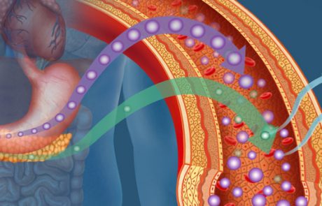 סוכרת סוג 2 עשויה לאותת לנו על התפתחותה שנים טרם אבחון רפואי