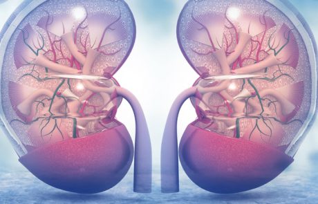 הפחתת סיכוי להיווצרות אבנים בכליות